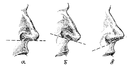 Рис. 42. Положение основания носа: а -горизонтальное; б - приподнятое; в - вогнутый; г - извилистый